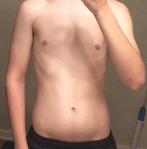 Personne démotivée - Option 1