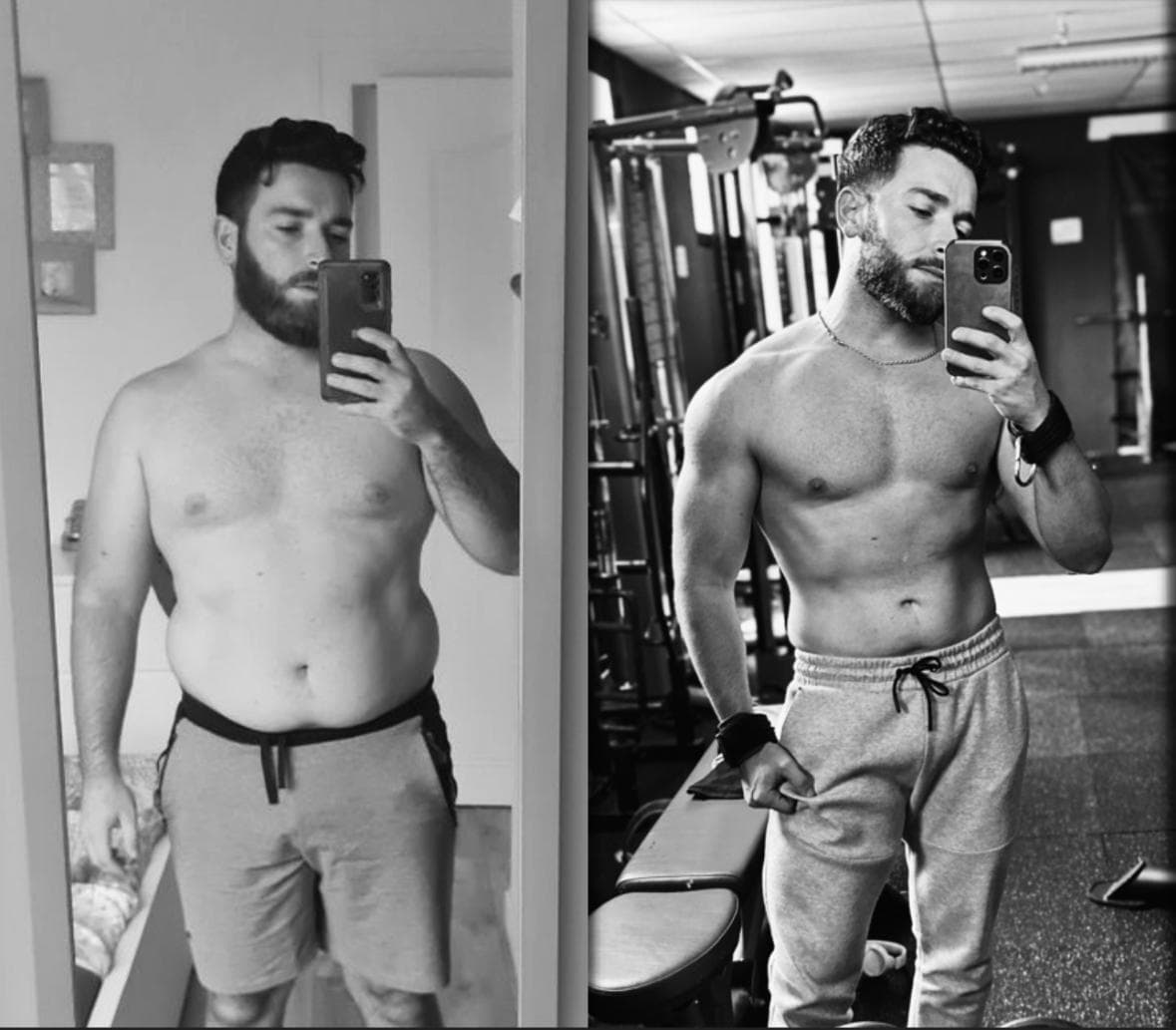 Dylan, 24 ans - Transformation avant/après